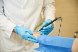 Podiatrist performing wart removal on female patient foot